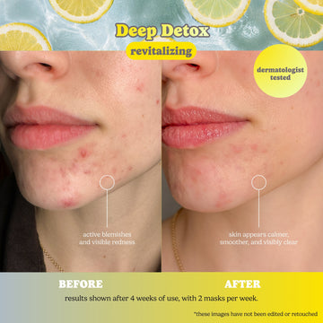Deep Detox Pore Control Raw Juice Mask